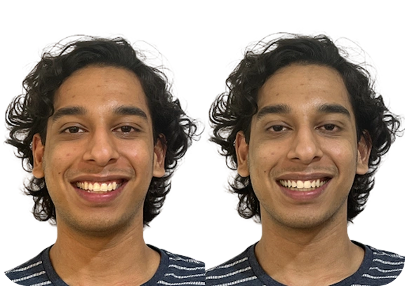 Advanced 3D Scanning & AI Technology