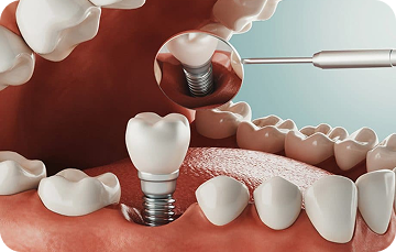 Preventive Dental Care Package
