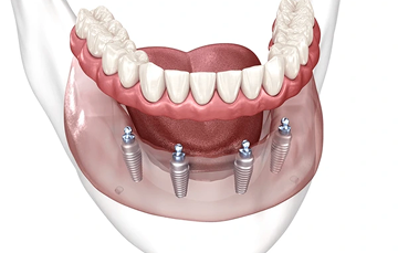 teeth-img