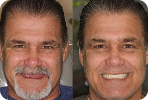 transform_img