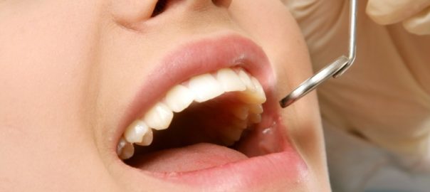 Dental myths busted