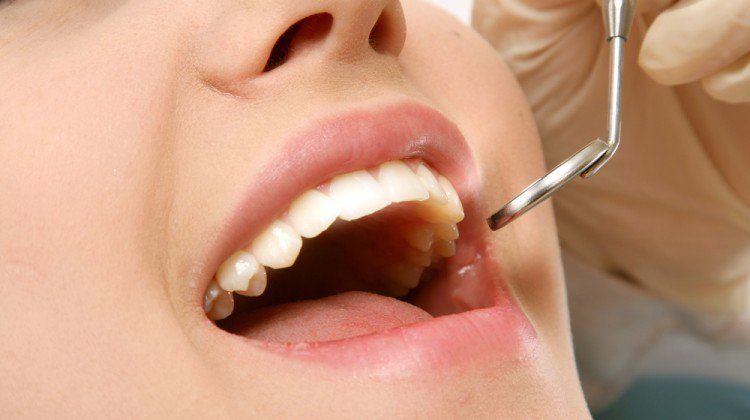 7 Dental Myths Need To Be Busted