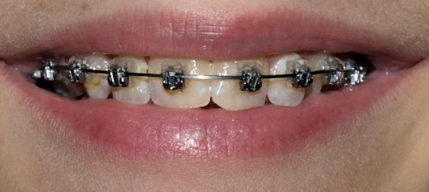 Dental Health Blog