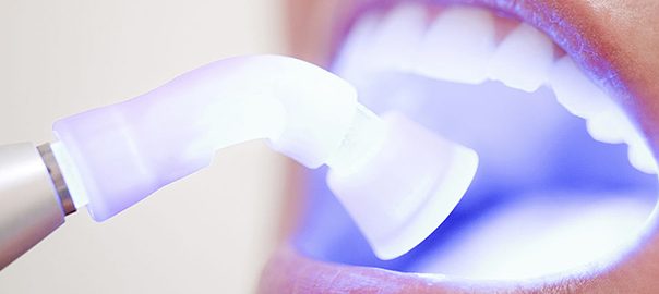 teeth-bleaching