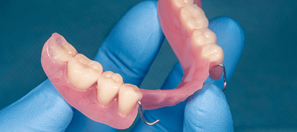 What to Expect With Partial Dentures