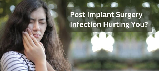 Implant Surgery Infection