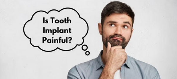 Tooth implant procedure