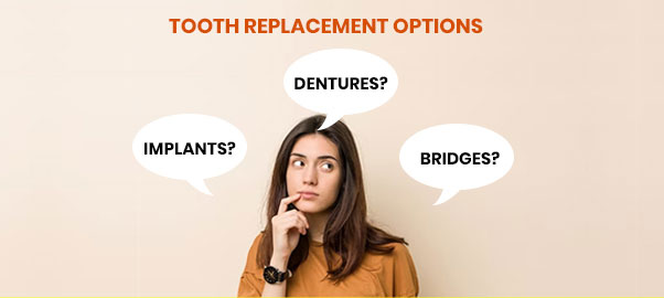 Types of Tooth Replacement Methods