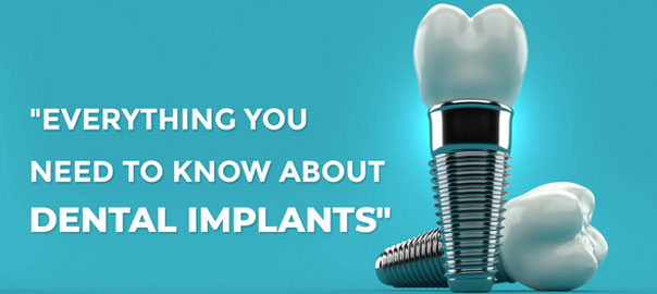 Learn About Dental Implants