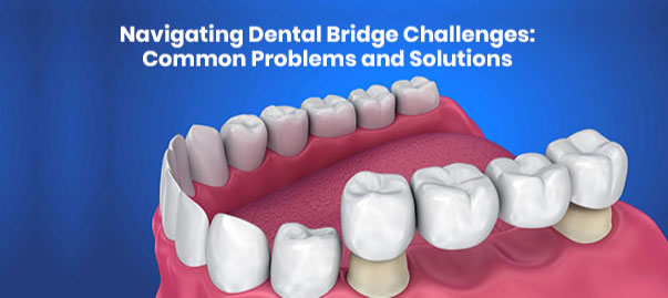 Disadvantages of Dental Bridges