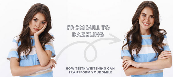 How Teeth Whitening Can Transform Your Smile