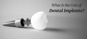 cost of dental implants