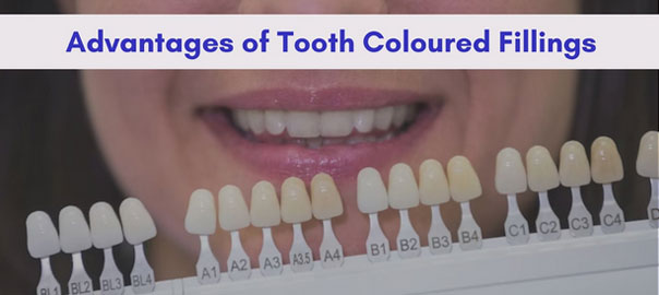 Teeth fillings procedure
