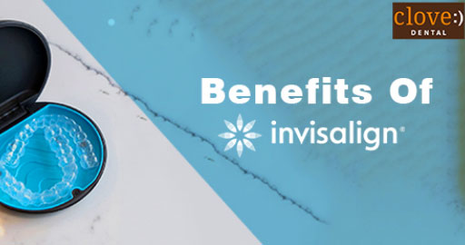 benefits of invisalign