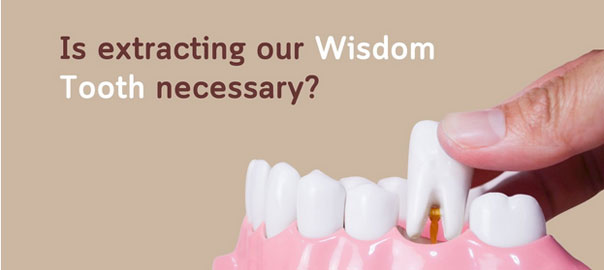 why wisdom teeth removed