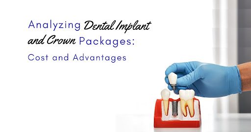 Benefits of Dental Implant and Crown