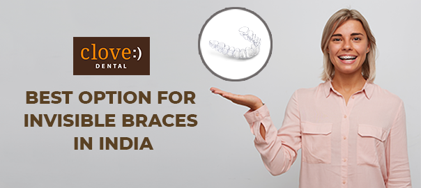 Best Option For Invisible Braces In India