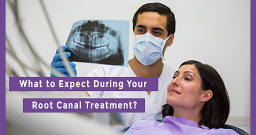 What to Expect During Your Root Canal Treatment