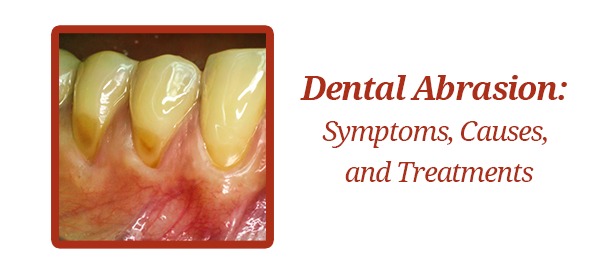 dental abrasion symptoms causes