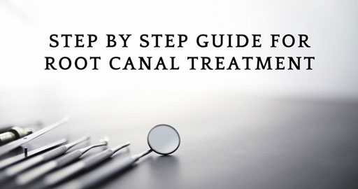 Root canal treatment steps