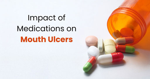 Impact of Medications on Mouth Ulcers