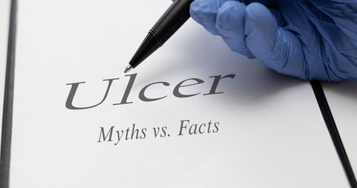 Ulcers Myths and Facts