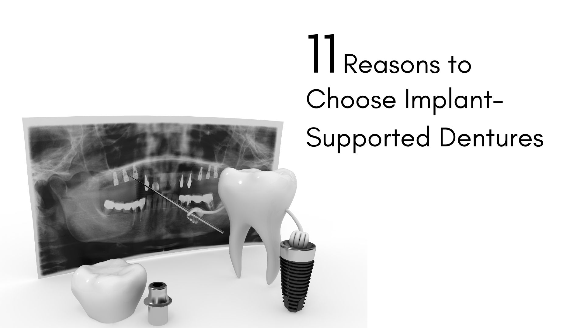 Implant Dentures 11 Reasons for a Smile Upgrade Clove Dental