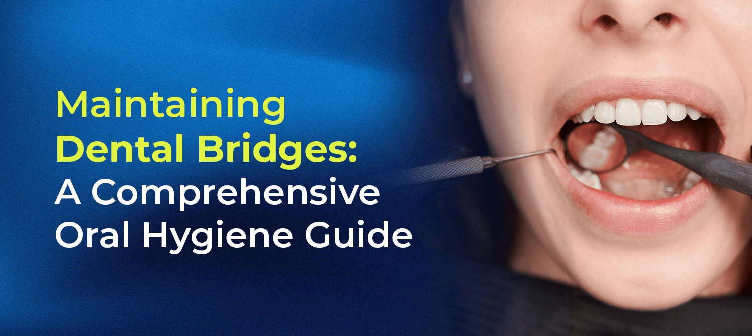 Oral Hygiene Maintenance Guide for Dental Bridges
