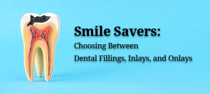 Dental Fillings vs Inlays and Onlays