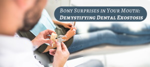 Dental Exostosis: Understanding Bony Growths in Your Mouth | Clove Dental