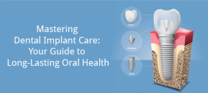 dental implants