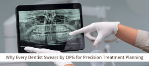 OPG for Precision Treatment Planning