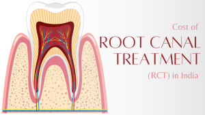 RCT cost in india