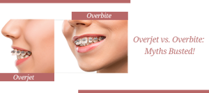 overjet overbite