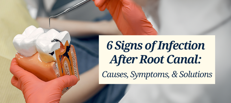 6 Signs of Infection After Root Canal Causes, Symptoms, and Solutions
